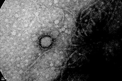 Image of SARS-CoV-2 taken by the Cell Biology and Neuroscience Institute "Professor E. de Robertis", UBA-CONICET.