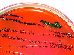 E. coli on EMB agar