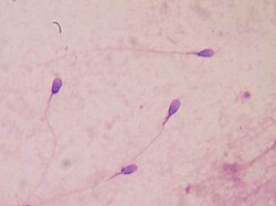Stained human sperm