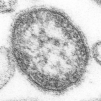 An electron micrograph of the measles virus