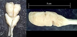 Dorsal / left lateral views of dissected hagfish brain, scale bar added for size