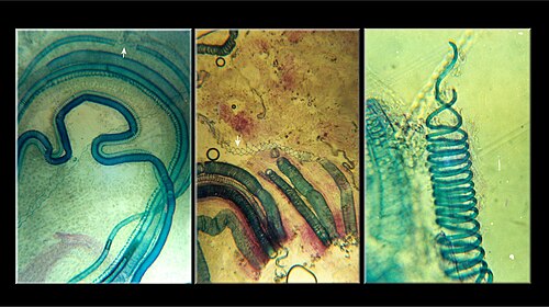 Xylem elements in the shoot of a fig tree (Ficus alba), crushed in hydrochloric acid