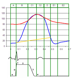 Partial Wiggers diagram.Red = aortic pressureBlue = left ventricular pressureYellow = left atrial pressure.
