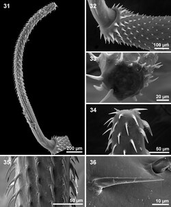 Scanning electron microscopy of proboscis of an Acanthocephala[8]