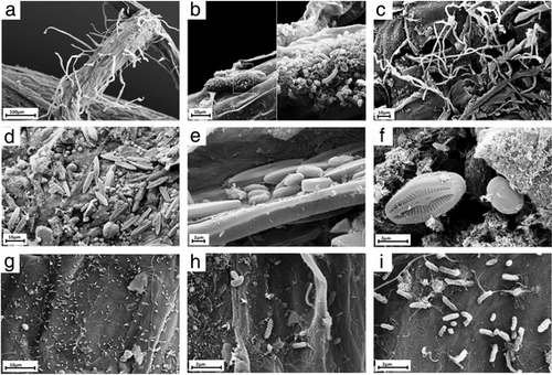 Microbial consortia naturally formedon the roots of Arabidopsis thaliana Scanning electron microscopy pictures of root surfaces from natural A. thaliana populations showing the complex microbial networks formed on rootsa) Overview of an A. thaliana root (primary root) with numerous root hairs, b) Biofilm-forming bacteria, c) Fungal or oomycete hyphae surrounding the root surface, d) Primary root densely covered by spores and protists, e, f) Protists, most likely belonging to the Bacillariophyceae class, g) Bacteria and bacterial filaments, h, i) Different bacterial individuals showing great varieties of shapes and morphological features[88]