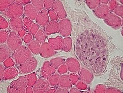 Cross section through skeletal muscle and a small nerve at high magnification (H&E stain)