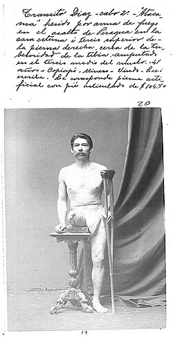 Photo of Chilean private first class Tránsito Diaz, injured during the landing on Pisagua. The photo belongs to the "Álbum de inválidos de la Guerra del Pacífico", 130 photographic records ordered by the D. Santa María government to demonstrate the pensions and orthopedic devices given to disabled war veterans.[126] Ten percent of the expeditionary force, 4,081 Chilean soldiers, returned disabled from the war. In 2008, 280 women were receiving a pension as the daughter or wife of a veteran.[127]: 20, 30