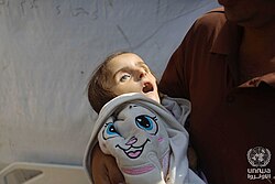 Dead four year old Palestinian girl, 14 August 2024