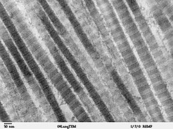 TEM image of collagen fibres in a cross sectional slice of mammalian lung tissue