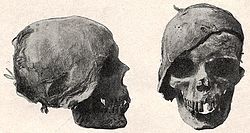 Skull of King Tabnit of Sidon (reigned c. 549 BC – c. 539 BC), now in the Istanbul Archaeology Museums