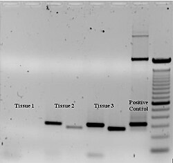 Ethidium bromide-stained PCR products after gel electrophoresis. Two sets of primers were used to amplify a target sequence from three different tissue samples. No amplification is present in sample #1; DNA bands in sample #2 and #3 indicate successful amplification of the target sequence. The gel also shows a positive control, and a DNA ladder containing DNA fragments of defined length for sizing the bands in the experimental PCRs.