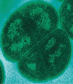 Deinococcus radiodurans is an extremophile that can resist extremes of cold, dehydration, vacuum, acid, and radiation exposure