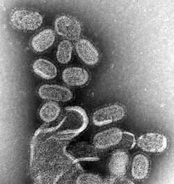 A transmission electron micrograph (TEM) of the reconstructed 1918 pandemic influenza virus. The bottom structure represents membrane debris from the cells used to amplify the virus.[15]
