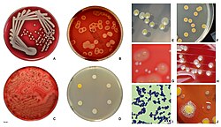 Staphylococcus aureus on basic cultivation media