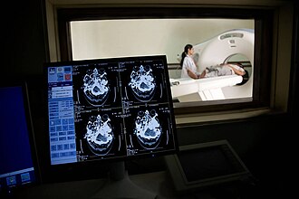 A modern medical imaging workstation monitoring a computed tomography (CT) brain scan, reflecting the advanced diagnostic and radiology infrastructure available across municipal and private healthcare networks in Navi Mumbai.