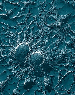 Bacterial cells of S. aureus, which is one of the causal agents of mastitis in dairy cows: Its large capsule protects the organism from attack by the cow's immunological defenses.