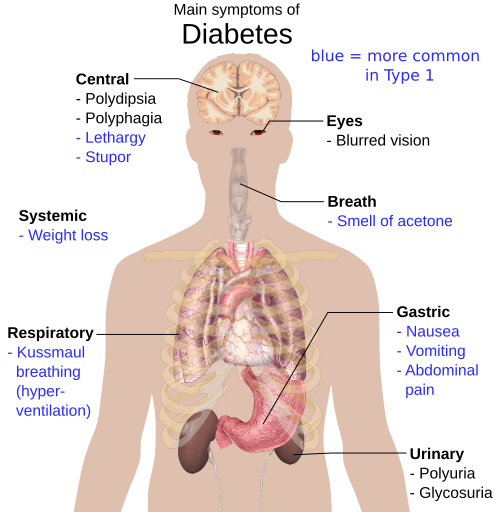 Overview of the most significant symptoms of diabetes