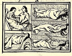Drawing accompanying text in Book XII of the 16th-century Florentine Codex (compiled 1555–1576), showing Nahuas of conquest-era central Mexico with smallpox