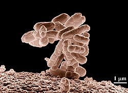 Fecal microbiota transplants are an experimental treatment for C. difficile infection.[179]