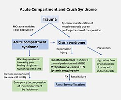 Crush syndrome progression. (Glossary: MC = most common, # = fracture, MODS = multiple organ dysfunction syndrome, RTN = renal tubular necrosis.)
