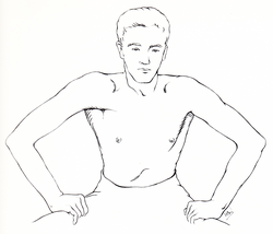 Absence of sternocostal head of right pectoralis major associated with compensatory hypertrophy of latissimus dorsi is not rare.[citation needed] It is revealed on pressing downwards with the arms.